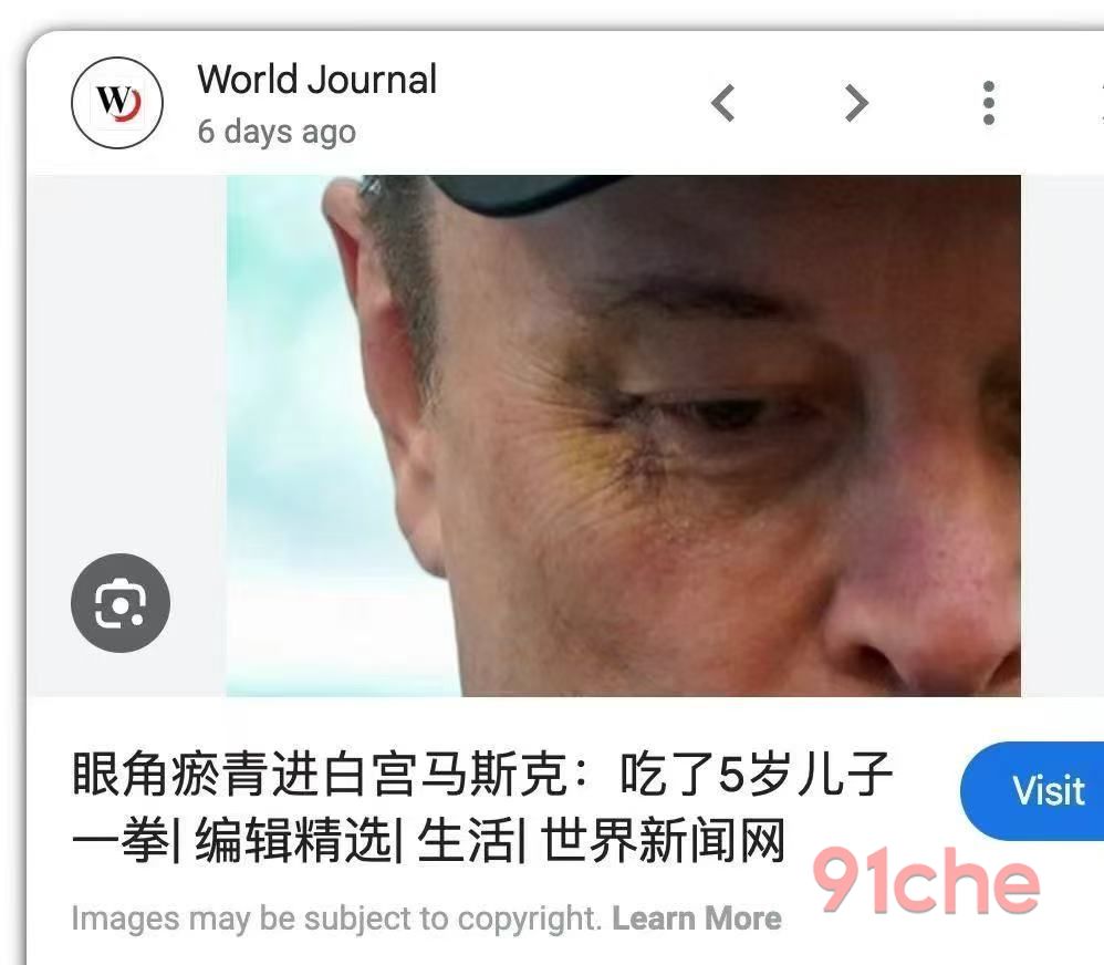 马斯克眼角淤青