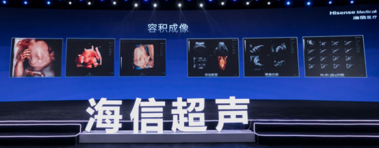 2、产品稿：最好用的超声来了！海信首台超声产品正式发布560.png