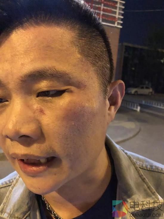 滴滴投资人称遭滴滴司机毒打：投了100万依然被打了