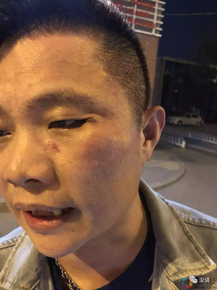 投资人叫车被滴滴司机殴打：滴滴回应向我泼脏水