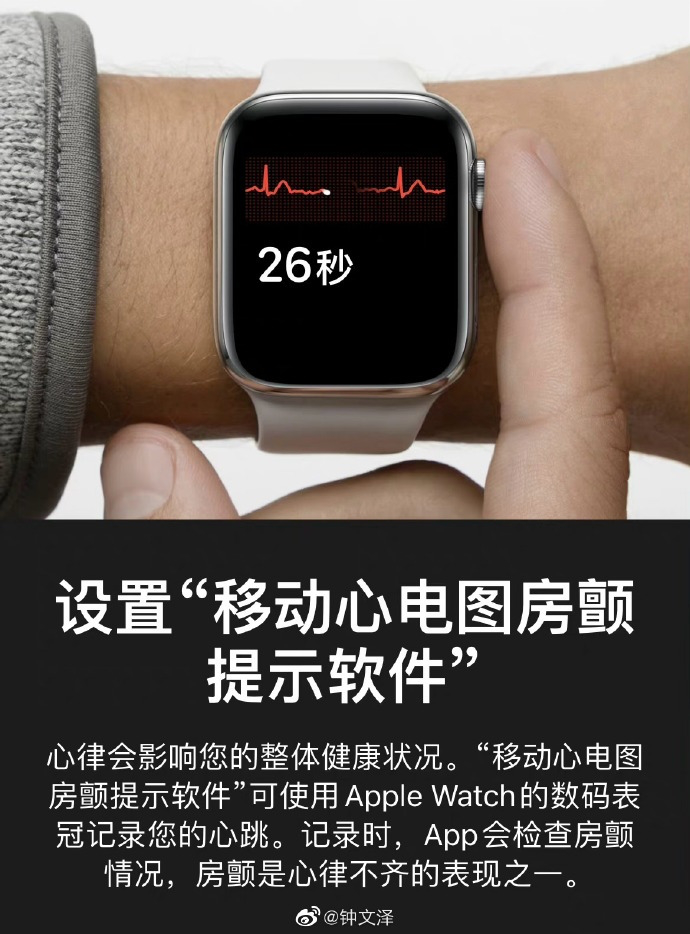 Apple Watch心电图.png