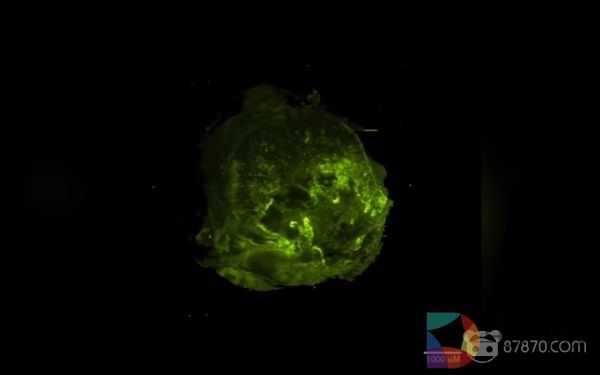 英国癌症研究机构拨款4000万英镑，剑桥大学用VR技术模拟癌细胞