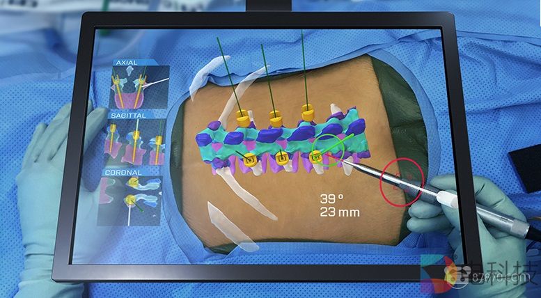 HoloSurgical将AR与AI结合融入医疗手术中
