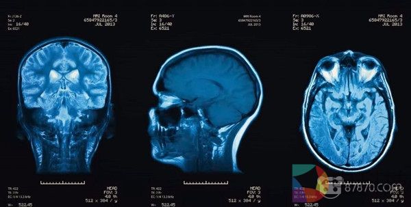 CrashCourse正式公布脑部保护VR课程内容