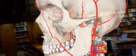 Medivis推出医疗教学AR平台AnatomyX
