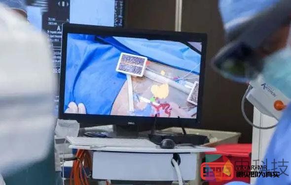 MediView XR获450万美元A轮融资为外科医生提供X光检查