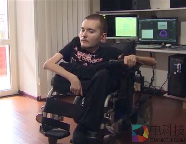 俄罗斯男子亲口承认：无望全球“换头”第一人